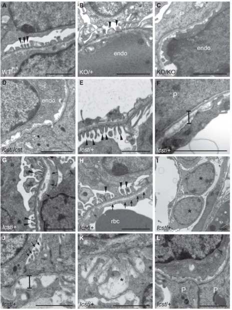 Figure 5. Ultrastructural analysis of E17.5 and E18.5 kidneys shows that IcstLmx1bWild-type (WT) and causes glomerular defects when heterozygous