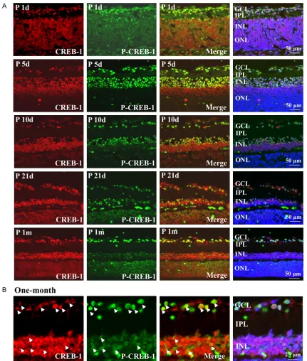Figure 1. Developmental expression profile of CREB-1 and p-CREB-1 in rat retina. A. The expression of CREB-1 (red) and p-CREB-1 (green) in the rat retina were observed at postnatal day 1, day 5, day 10, day 21 and 1 month by us-ing immunofluorescence stain