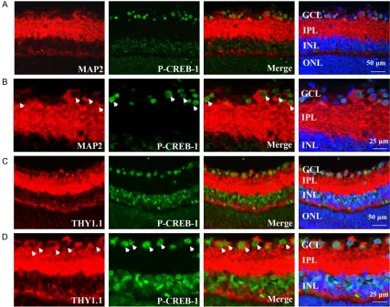 Figure 2. Immunolocalization of p-CREB-1 in the adult rat retina neurons. A. P-CREB-1 immunoreactivity in the rat retina co-localized with Map-2 positive cell