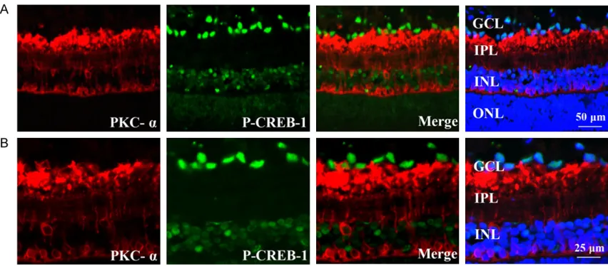 Figure 3. No clear co-localization was detected between PKC-α and p-CREB-1. A. Noimmunoreactivity of p-CREB (green) were observed in PKC-α (red) positive bipolar cells