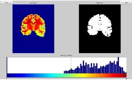 Fig 6 : Expert intervention Image 