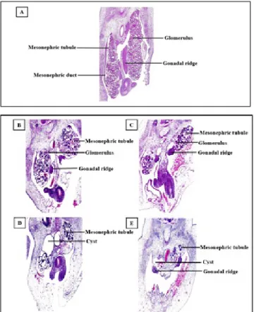 Fig 6. A, B, C, D were serial sections of day 6 chick embryo injected  with 1 mg of MSG, section number 5, 15, 45 and 55, respectively to  show multiple malformations in the same embryo