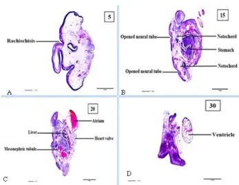 Fig 9. A, B, C, D were serial section of day 6 chick embryo injected  with 3 mg of MSG, section number 5, 15, 20 and 30, respectively to  show multiple malformations in the same embryo