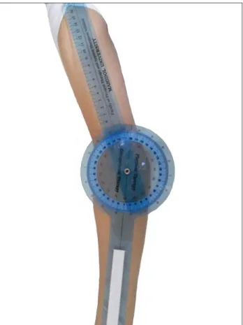 Fig 1. The carrying angle was measured using a clear plastic full-circle  orthopedic goniometer