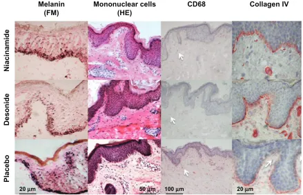Table 2 Changes in colorimetric values (L*∆, a*∆), melanin content, mononuclear cells, nKI/Beteb, CD1a, CD68, collagen IV expression, and epidermal thickness in axillae treated with niacinamide, desonide, and placebo