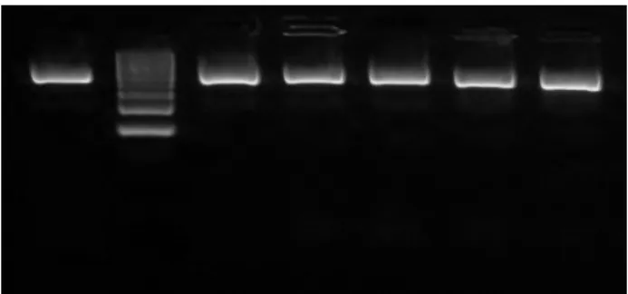 Figure 2. Multiplex PCR identification of E. faecium  (215 bp) and E. faecalis (941 bp) 