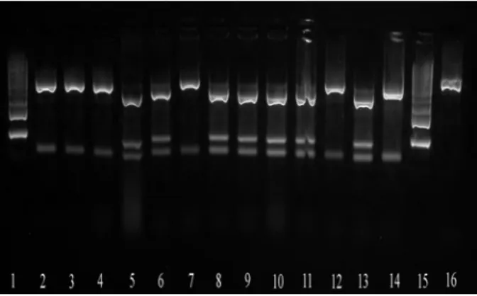 Figure 3. Restriction DNA fragments of E. faecium  (370; 63bp) and E. faecalis (285; 85; 63bp) obtained  with digestion of PCR product (16S rDNA 433bp) with 