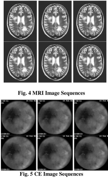 Fig. 4 MRI Image Sequences 