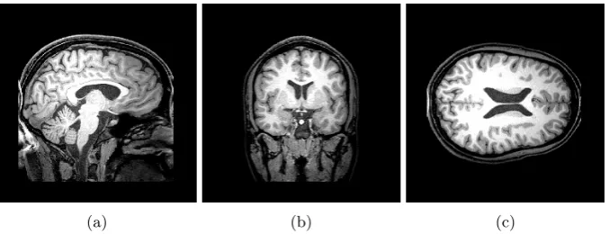 Fig. 1: Example of a 3-D brain MRI scan: (a) Sagittal (SAG) plane; (b) Coronal(COR) plane; (c) Transverse (TRA) plane