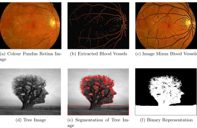 Figure 3.10: Examples to demonstrate image segmentation. On the top row, we showretinal vessel segmentation of a Colour Fundus Angiography image