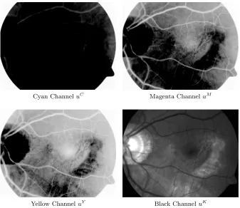 Figure 2.3: Two diﬀerent views of the surface representation of the green channel ofthe Colour Fundus image given in Figure 2.2c.