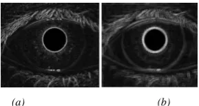 Fig 3: (a) Image obtained after finding the inner boundary (Pupil); (b) Image obtained after finding the outer 