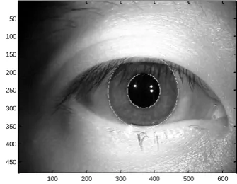 Fig.10: segmentation of a noisy iris image