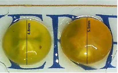 Figure 1.5: Photograph demonstrating age related differences in lenses.  A. Young lens donor – Lens is smaller, more transparent and paler in colour when compared to an older lens