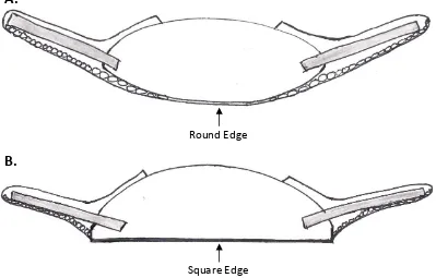 Figure 1.17: Schematic of round and square-edge designed IOLs: A. Round-edge IOL does not cause a bend in  