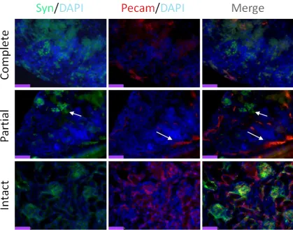 Figure 14: Pecam/Synaptopodin Immunofluorescence: Complete or Partial Disaggregation? 