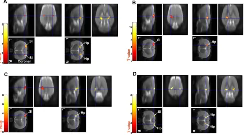 Table 1. Significant voxels in the primary somatosensory cortex for the 1st, 3rd and 9th postoperative day, normalized by the totalpreoperative amount.