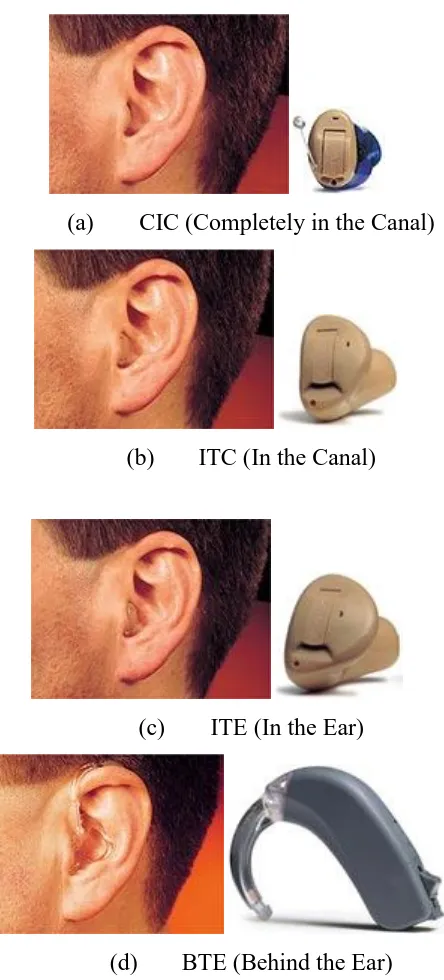 Figure 1.2 Conventional hearing aids technologies 