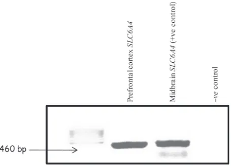 Fig. 2 Agarose gel showing the reverse transcription PCR products ofthe SLC6A4 gene ampliﬁed from sections of neonatal Wistar rat brain.Lane 1: Mass ruler DNA Ladder; lane 2: SLC6A4 RT-PCR ampliﬁca-tion from rat prefrontal cortex, amplifying a 460 bp cDNA 