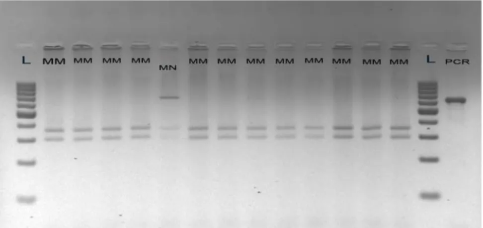 Figure 1:   Representatively  results of analysis PCR-RFLP for CAST gene by restriction  enzyme MspI on 2 % agarose gel