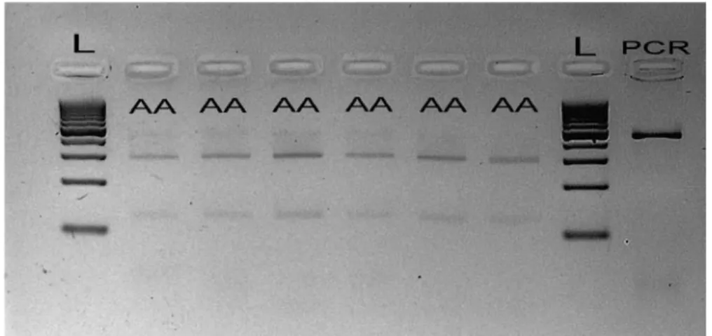 Figure 3:   Representatively  results of analysis PCR-RFLP for CLPG gene by restriction  enzyme FaqI on 3 % agarose gel