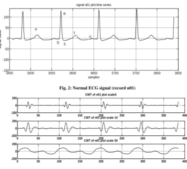 Fig. 2: Normal ECG signal (record n01)samples 