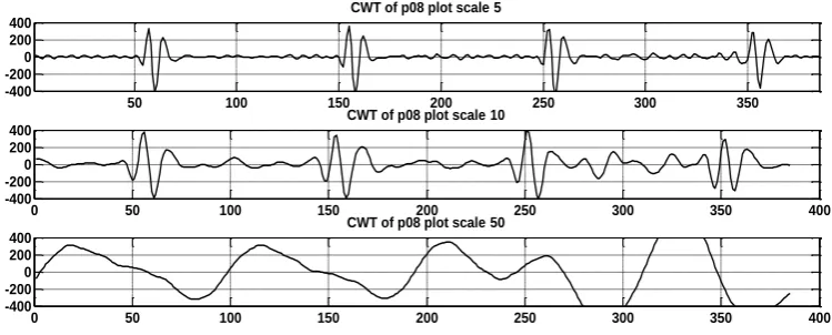Fig. 4 ECG signal preceding PAF (record p08) 
