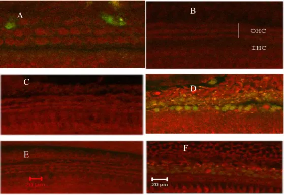 Figure 3. Activation of caspase 8 (green) and PI nuclear staining (red). Nuclei of apoptotic  cells appear bright red and round and the cytoplasm stained green