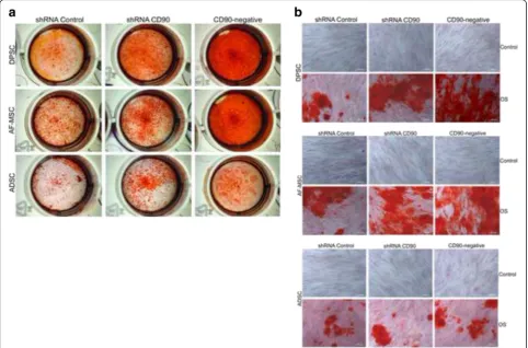 Fig. 6 Reduction of CD90 expression stimulates MSC osteogenesis. MSCs, shRNA control MSCs, shRNA CD90 MSCs, and CD90-negative MSCs fromdental pulp (DPSC), amniotic fluid (AF-MSC) and adipose tissue (ADSC) were tested in parallel for their ability to differ