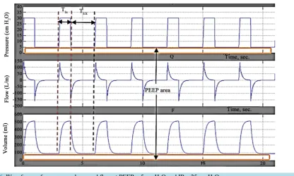 Figure 6. Waveforms of pressure, volume and flow at PEEP = 5 cm H2O and IP = 25 cm H2O