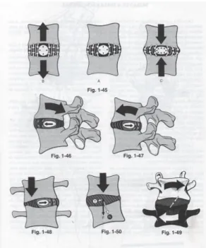 Figure 02: Displacement of intervertebral discs  during the movements of the vertebral column  (Kapandji, 2000, p.43)