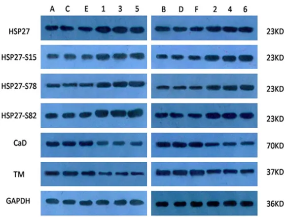 Figure 3 Detection of the expression of HSP27, specific phosphorylated HSP27, CaD and TM with WB (ABCDEF: DM models; 123456: con- trols).