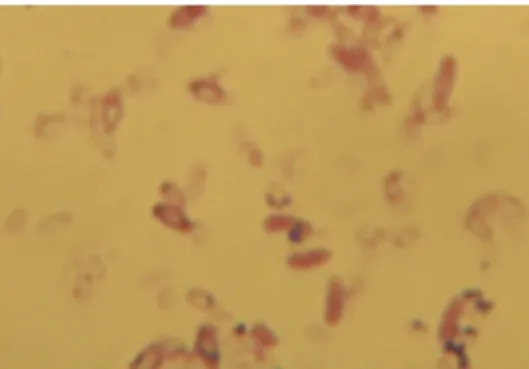 Fig 5. Beluga sturgeon with inflamed  Fig 6. The morphological exam of the Gram 