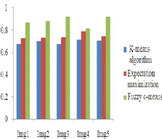Fig. 14. Probability Random index for five different brain  MR image segmentations using K-means, Expectation and maximization and Fuzzy c-means algorithm  