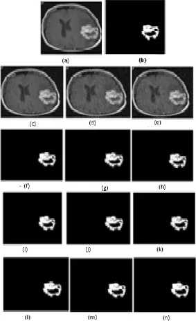 Figure. 2 Image segmentation of  brain MR image of size (165175)-(a) original image and (b) ground truth tumor image , (c), (d) and (e)Gaussian noise images with 3, 5 and 7% respectively; (f), (g) and (h) corresponding segmented tumor images using k-means