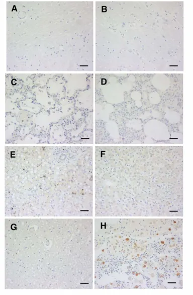 Figure 5HO-1 staining of tissues from controlsare also shown. Pattern shown was the same in all cases illustrated