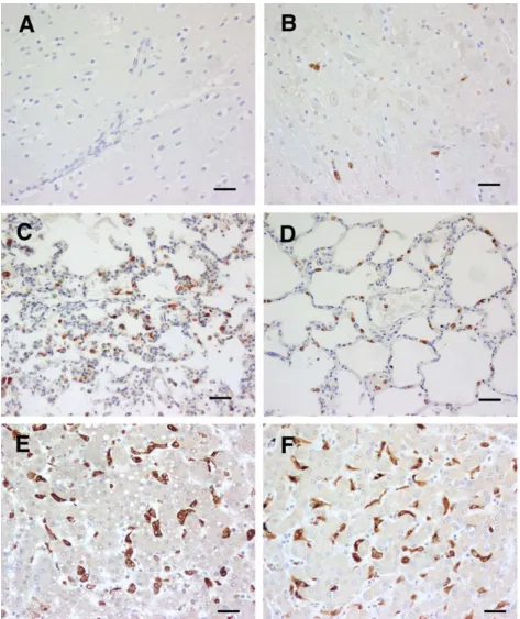 Figure 1CM (A). HO-1 staining of tissues from cerebral malaria cases showing apparently absent physical brain pathologyogy