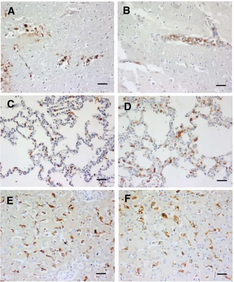 Figure 3CM (C). HO-1 staining of tissues from cerebral malaria cases showing physically apparent brain pathology, plus sequestered 100 parasites presentCM (C)