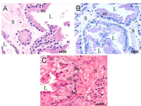 Figure 1Histological appearance of normal (A), BPH (B) and PCa canine prostate tissues incorporated in this studyHistological appearance of normal (A), BPH (B) and PCa canine prostate tissues incorporated in this study