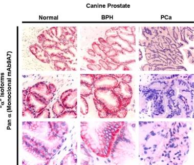 Figure 3Comparing the immunohistochemical localization of Na, K-ATPase "monoclonal antibody (mAb9A7) that recognizes all known α isoformsα " subunits in normal, BPH and PCa tissues using a pan α Comparing the immunohistochemical localization of Na, K-ATPas