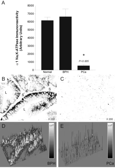Figure 5Quantitative analysis of Na, K-ATPase immunoreactivity in normal, BPH and PCa canine prostateQuantitative analysis of Na, K-ATPase immunoreactivity in normal, BPH and PCa canine prostate