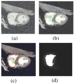 Figure 4. (a) Axial image (b) Resultant image after filtering(c) User defined seed point green for object and 