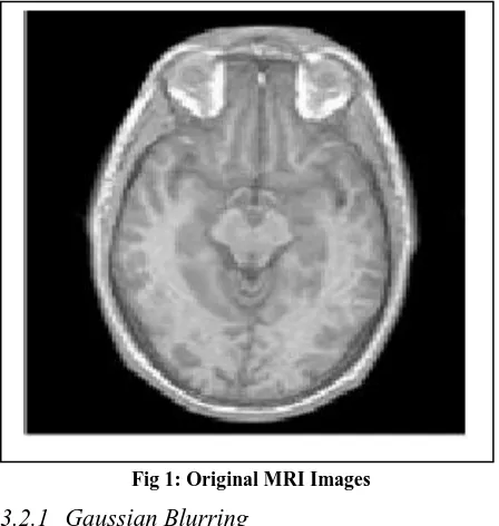 Fig 2: Gaussian blurred MRI image 