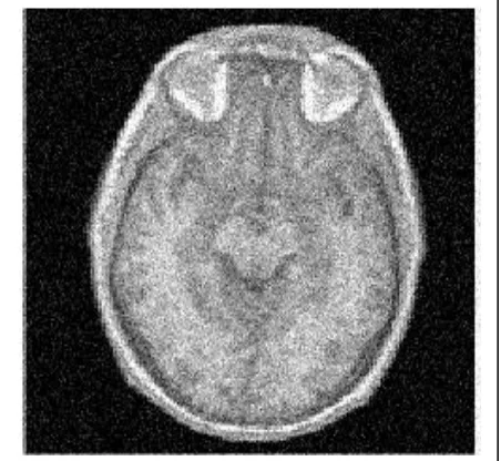 Fig 4: Out of Focus MRI Image 