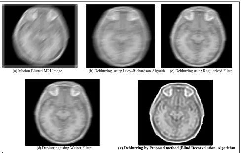 Fig 7: Gaussian noise removal results of MRI image 