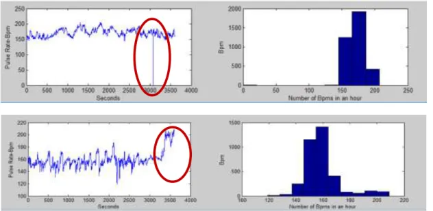Fig -2: Example of  a- Missing Data: Pulse Rate value of record of ‘0’  