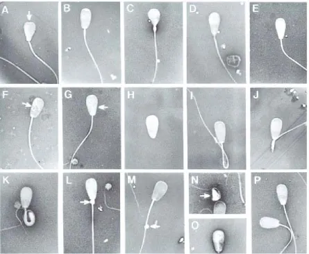Figure 1.5. Examples of common morphological problems of spermatozoa.
