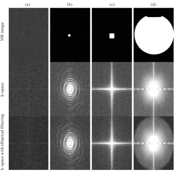 Figure 1. Phantoms with homogeneous physical structure. (a) air; (b) small water sphere; (c) small water cube; (d) large spherical phantom for quality assurance