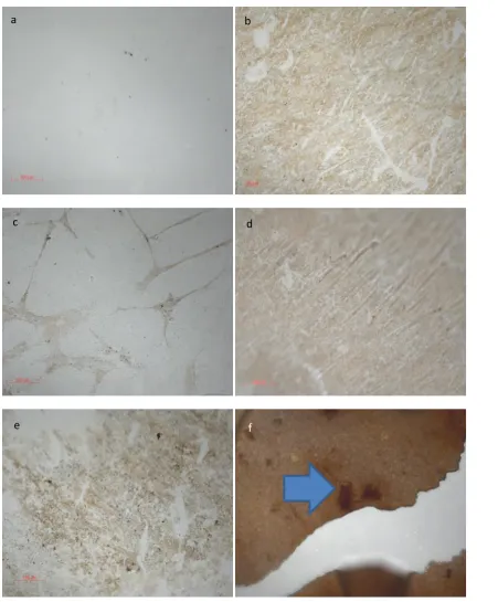 Figure 4.9:  MSC on modified glass after 7 days incubation MSCs on modified glass after 7 days incubation and stained with Von Kossas stain for mineralisation, (a) unmodified glass, (b) CL3, (c) CL4, (d) CL6
