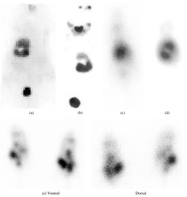 Figure 6. Iodine-125 (125I) imaging in a BALB/c mouse. (a) Planar mode imaging with the Inveon scanner; (b) Single-photon emission computed tomography (SPECT) imaging using the Symbia TruePoint system; (c) Planar mode imaging using the Inveon scanner; (d) 